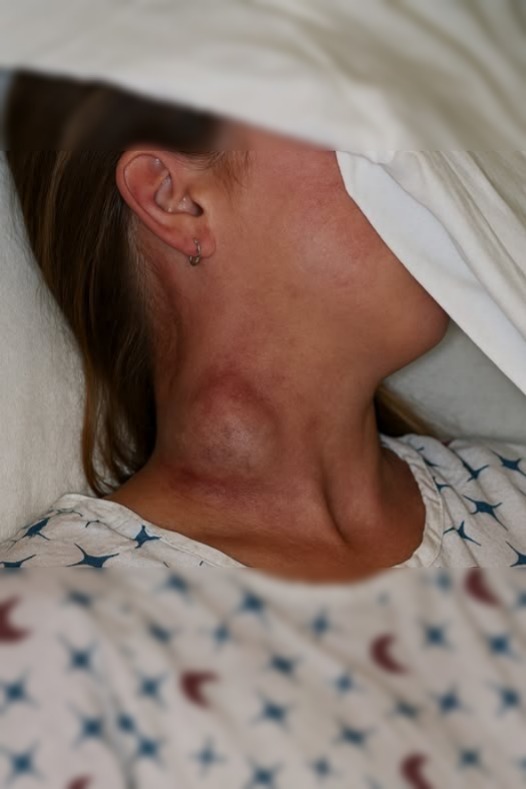 Estas son las consecuencias de dormir con un…Ver más