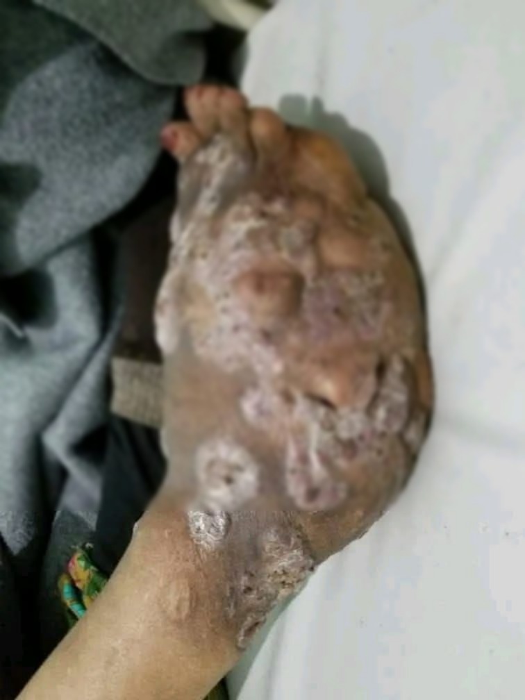 Estas son las consecuencias de dormir co00..ver mas