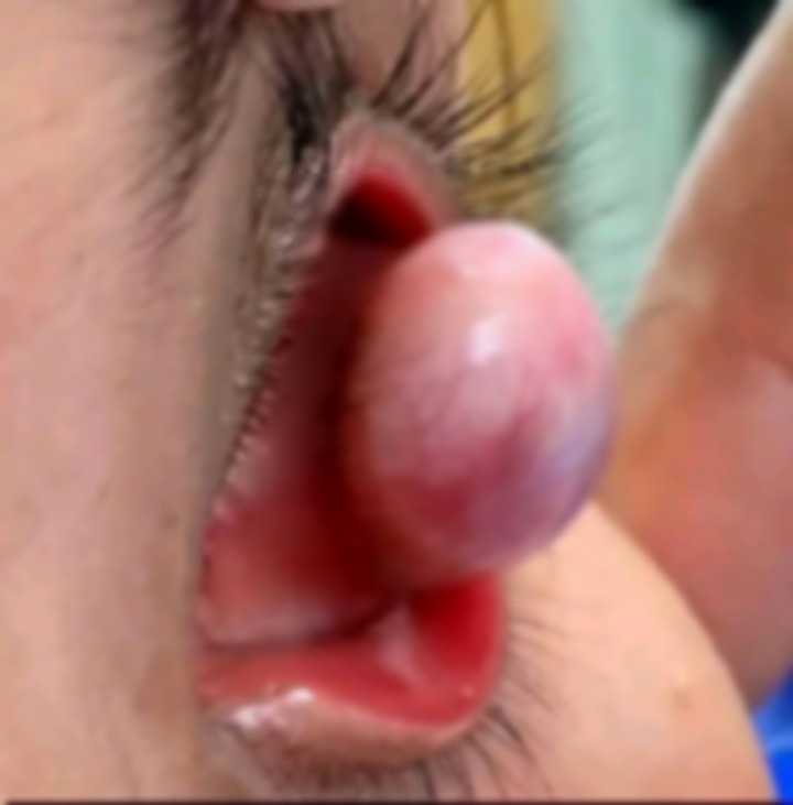 Estas son las consecuencias de tener relac10nes por66… Ver más