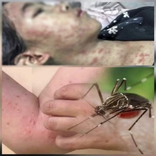 Cuidado estas son las consecuencias de dormir co001…Ver más
