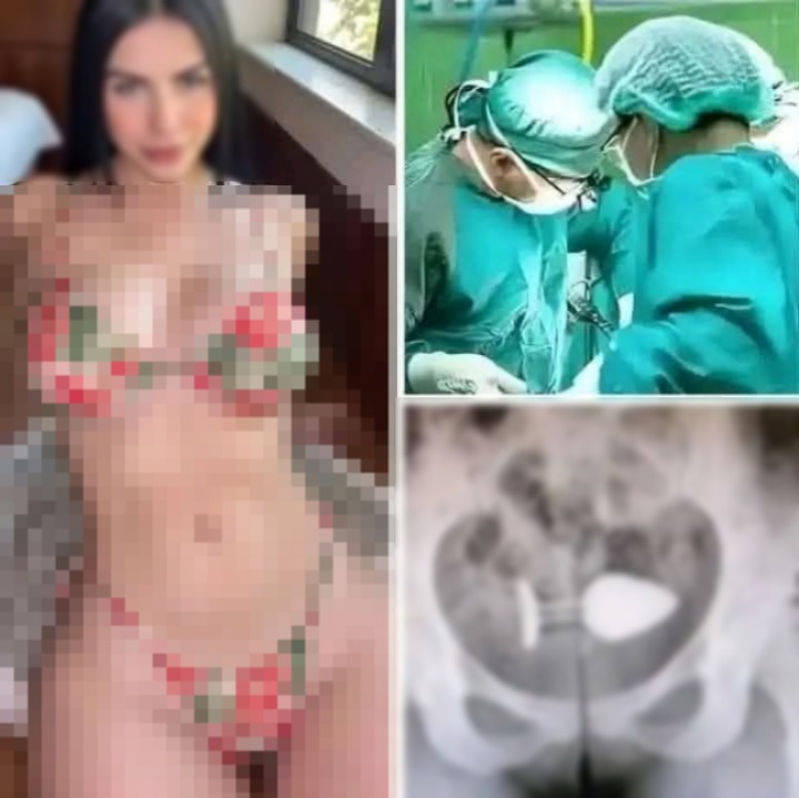 😱Chica fue h0spital1zada por pr0bar un..Ver más