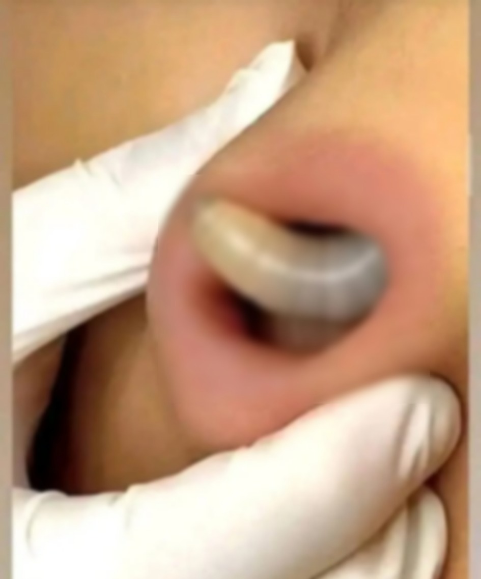 Encuentran larva en una j0ven muj0…Ver más